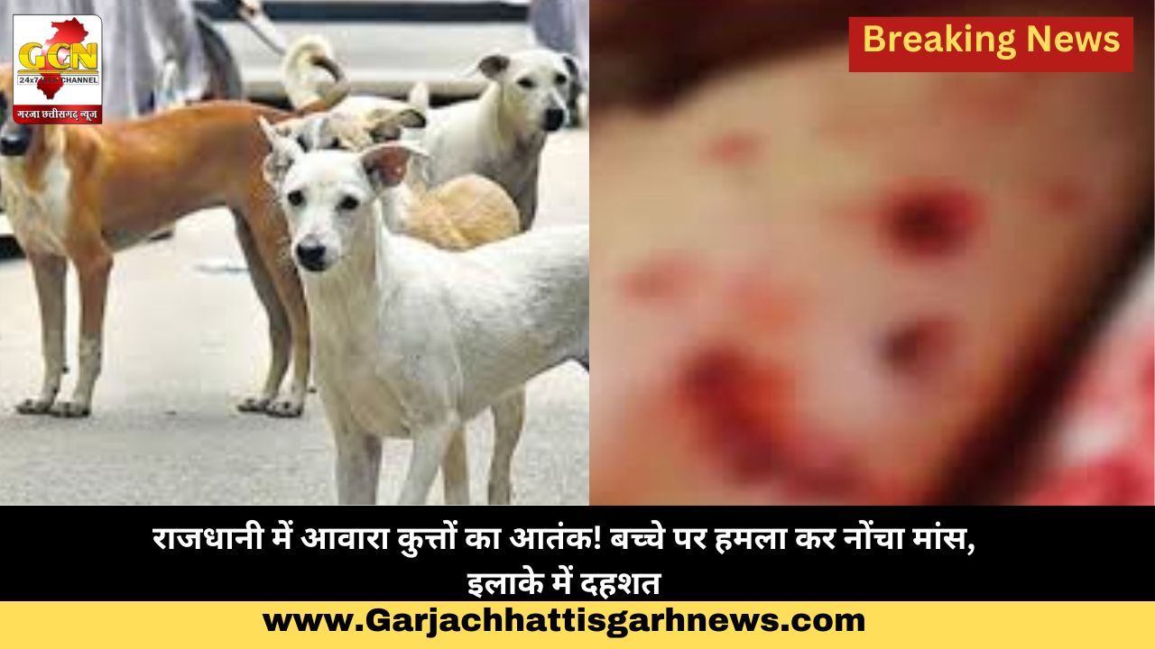 राजधानी में आवारा कुत्तों का आतंक! बच्चे पर हमला कर नोंचा मांस, इलाके में दहशत